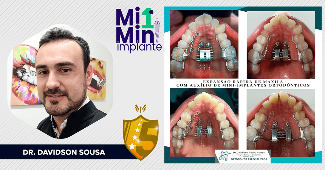 1-slide-novo